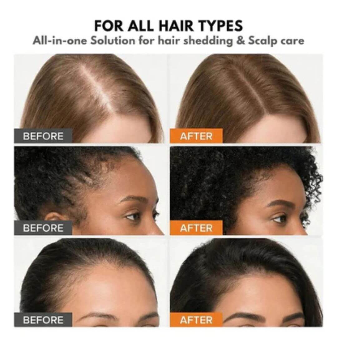 Korean Hair Growth Serum
