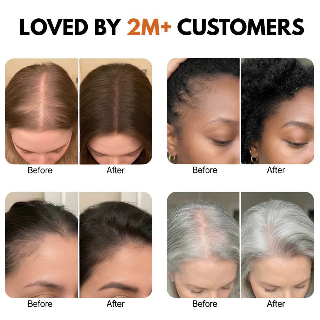 Korean Hair Growth Serum