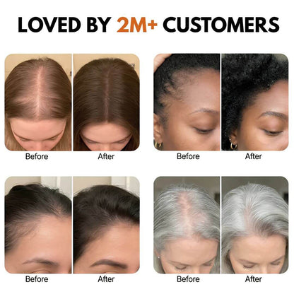 Korean Hair Growth Serum